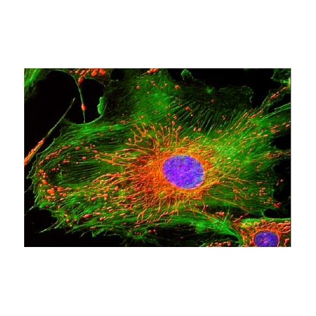 Microscopio Trinocular de Fluorescencia HBO, 2 Filtros