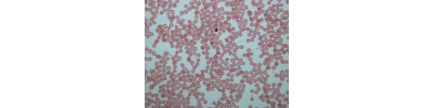 Hematología