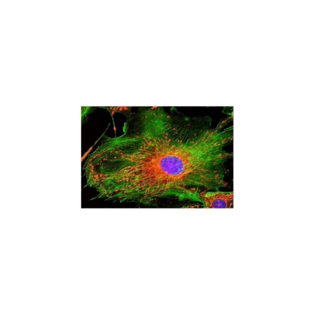 Microscopio Trinocular de Fluorescencia HBO, 2 Filtros