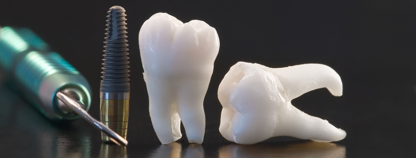 Dental